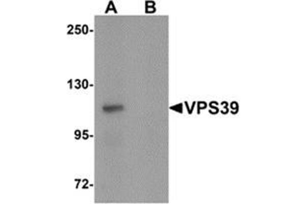 anti-Vacuolar Protein Sorting 39 Homolog (VPS39) (C-Term) antibody