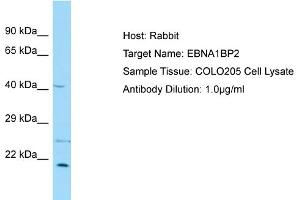Image no. 1 for anti-EBNA1 Binding Protein 2 (EBNA1BP2) (Middle Region) antibody (ABIN2789958)