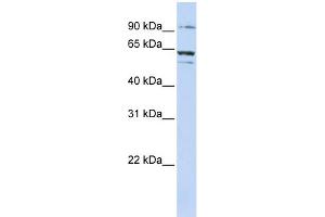 anti-ATP-Binding Cassette, Sub-Family E (OABP), Member 1 (ABCE1) (C-Term) antibody