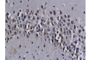 Immunohistochemistry (IHC) image for anti-Allograft Inflammatory Factor 1 (AIF1) (AA 51-147) antibody (ABIN685477)