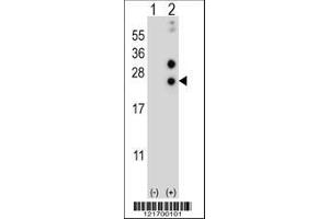 Image no. 1 for anti-Casein alpha S1 (CSN1S1) (AA 36-65) antibody (ABIN656838)