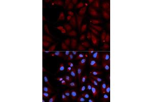 Image no. 4 for anti-Monoamine Oxidase B (MAOB) antibody (ABIN3022152)