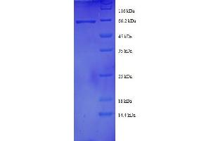 Image no. 1 for DnaJ (Hsp40) Homolog, Subfamily B, Member 1 (DNAJB1) (AA 1-340), (full length) protein (GST tag) (ABIN1608091)