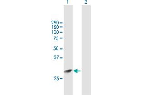 anti-Inhibitor of Growth Family, Member 4 (ING4) (AA 1-249) antibody