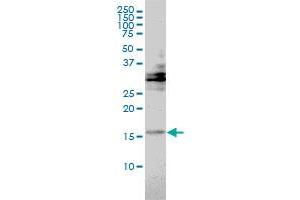 Image no. 2 for anti-Trafficking Protein Particle Complex 2 (TRAPPC2) (AA 1-140) antibody (ABIN562834)