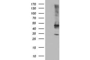 Image no. 2 for anti-Tubby Like Protein 3 (TULP3) antibody (ABIN2734600)