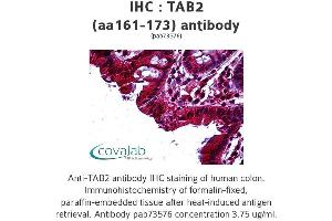 Image no. 1 for anti-TGF-beta Activated Kinase 1/MAP3K7 Binding Protein 2 (TAB2) (AA 161-173), (Internal Region) antibody (ABIN1739872)