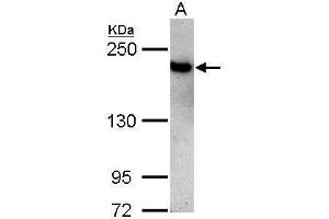 Image no. 2 for anti-Topoisomerase (DNA) II beta 180kDa (TOP2B) (C-Term) antibody (ABIN2855447)