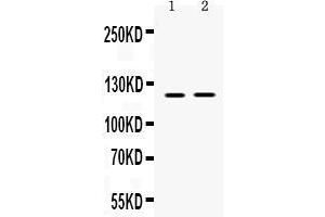 Image no. 3 for anti-Ceruloplasmin (Ferroxidase) (CP) (AA 20-258) antibody (ABIN3044508)