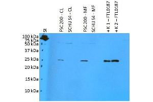 Western blotting analysis of polyclonal anti-Francisella tularensis subsp.