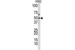 Image no. 3 for anti-Kruppel-Like Factor 11 (KLF11) antibody (ABIN3002716)