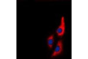 Image no. 1 for anti-Myosin Regulatory Light Chain 2, Smooth Muscle Isoform (MYL9) (N-Term) antibody (ABIN3071091)