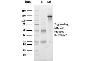 TIGIT antibody  (AA 22-141)