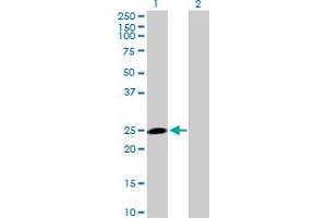 anti-HECT Domain Containing 3 (HECTD3) (AA 1-210) antibody