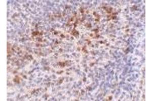 Image no. 1 for anti-Cathelicidin Antimicrobial Peptide (CAMP) (C-Term) antibody (ABIN499581)