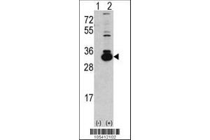 Image no. 2 for anti-Ketohexokinase (KHK) (AA 251-281), (C-Term) antibody (ABIN391089)
