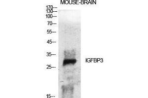 Image no. 2 for anti-Insulin-Like Growth Factor Binding Protein 3 (IGFBP3) (Ser53) antibody (ABIN3185137)