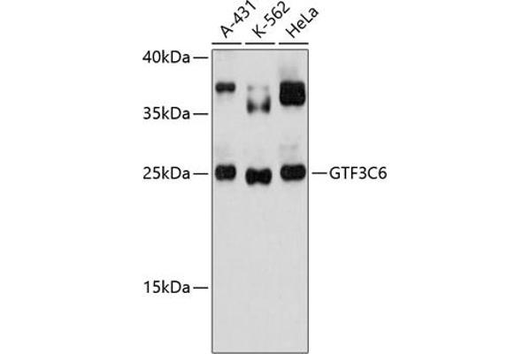 GTF3C6 anticorps  (AA 1-213)