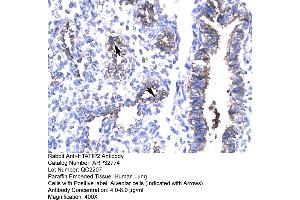 Image no. 1 for anti-HIV-1 Tat Interactive Protein 2, 30kDa (HTATIP2) (N-Term) antibody (ABIN2777583)