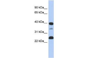 Image no. 1 for anti-Thymopoietin (TMPO) (N-Term) antibody (ABIN2782012)