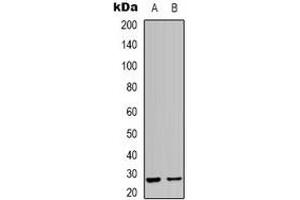 Image no. 3 for anti-Heat Shock 27kDa Protein 2 (HSPB2) (C-Term) antibody (ABIN2801250)
