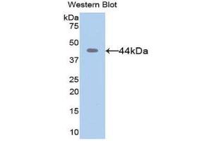 Image no. 1 for anti-Matrix Metallopeptidase 8 (Neutrophil Collagenase) (MMP8) (AA 101-467) antibody (ABIN1078309)