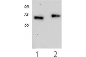 Image no. 2 for anti-Cytokine Receptor-Like Factor 2 (CRLF2) antibody (ABIN1106837)
