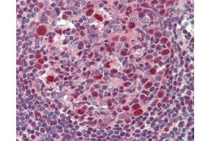 Image no. 4 for anti-B-Cell CLL/lymphoma 6 (BCL6) (Internal Region) antibody (ABIN2855012)