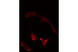 Image no. 2 for anti-Ring Finger Protein 14 (RNF14) antibody (ABIN6257647)