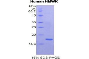Image no. 1 for Kininogen (High Molecular Weight) (AA 58-176) protein (His tag) (ABIN1877392)