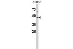 Image no. 1 for anti-ARP3 Actin-Related Protein 3 (ACTR3) (C-Term) antibody (ABIN452721)