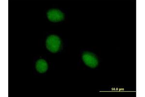 Immunofluorescence of purified MaxPab antibody to ZBTB6 on HeLa cell.