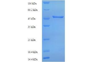 Image no. 1 for Hemagglutinin Esterase (HE) (AA 19-424) protein (His tag) (ABIN5714060)