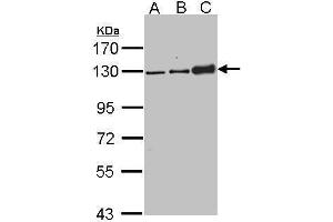 Image no. 2 for anti-Desmoglein 2 (DSG2) (N-Term) antibody (ABIN2855411)