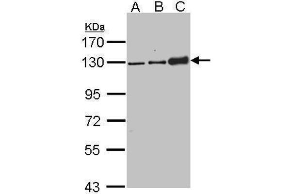 Desmoglein 2 Antikörper  (N-Term)