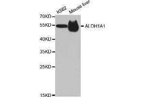 Image no. 1 for anti-Aldehyde Dehydrogenase 1 Family, Member A1 (ALDH1A1) antibody (ABIN3022573)