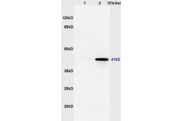 FOXE1 Antikörper  (AA 101-200)