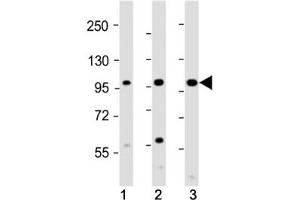 Image no. 5 for anti-Colony Stimulating Factor 1 Receptor (CSF1R) (AA 895-923) antibody (ABIN3028575)