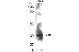 Image no. 2 for anti-Absent in Melanoma 2 (AIM2) (Internal Region) antibody (ABIN3183208)
