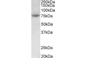 Image no. 1 for anti-Protein Arginine Methyltransferase 7 (PRMT7) (Internal Region) antibody (ABIN5539655)
