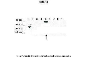 Image no. 3 for anti-SMAD, Mothers Against DPP Homolog 5 (SMAD5) (Middle Region) antibody (ABIN2779414)