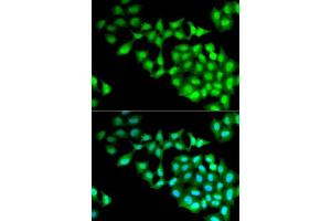 Image no. 2 for anti-RNA Guanylyltransferase and 5'-Phosphatase (RNGTT) antibody (ABIN6147053)