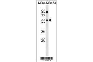Image no. 2 for anti-beta-1,4-N-Acetyl-Galactosaminyl Transferase 1 (B4GALNT1) (AA 296-323) antibody (ABIN1538263)