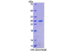 Arx Protein (AA 25-246) (T7 tag,His tag)