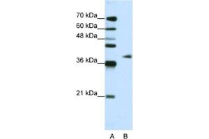 Image no. 1 for anti-Adenosine Deaminase, tRNA-Specific 1 (ADAT1) antibody (ABIN2462240)