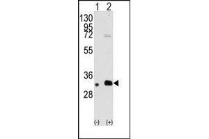 MAGEB2 antibody  (N-Term)
