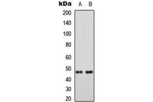 Image no. 2 for anti-Mitochondrial Ribosomal Protein S5 (MRPS5) (C-Term) antibody (ABIN2705010)