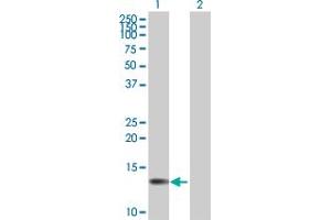 Western Blot analysis of FSD1L expression in transfected 293T cell line by FSD1L MaxPab polyclonal antibody.