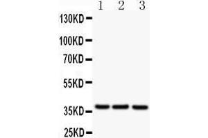 Image no. 5 for anti-CD79b Molecule, Immunoglobulin-Associated beta (CD79B) (AA 29-229) antibody (ABIN3043398)