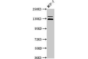 ZNF335 Antikörper  (AA 672-909)